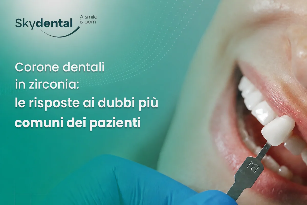 Corone dentali in zirconia: le risposte ai dubbi più comuni dei pazienti