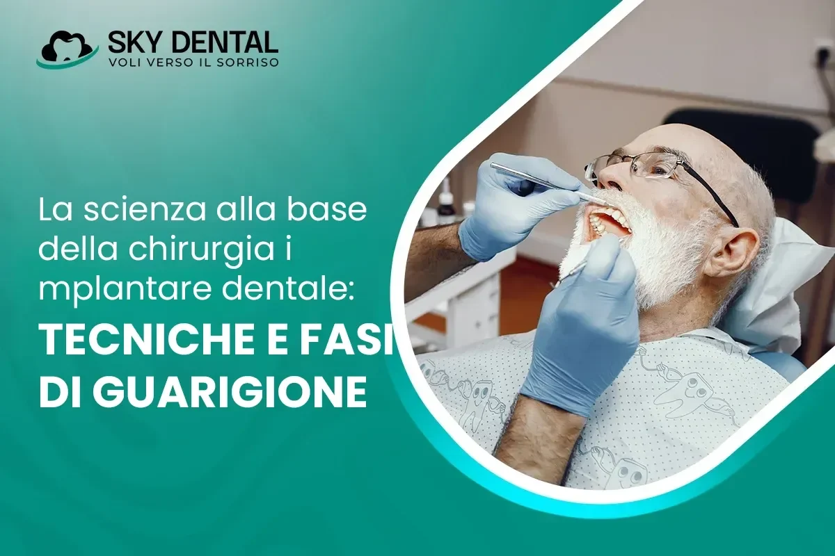La Scienza Dietro la Chirurgia degli Impianti Dentali: Tecniche e Fasi di Guarigione