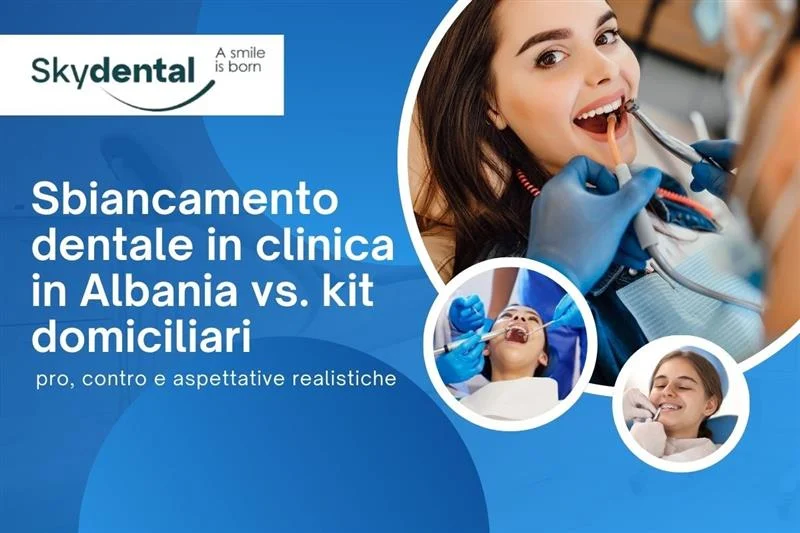 Sbiancamento Dentale in Clinica in Albania vs. Kit a Casa: Pro, Contro e Aspettative Realistiche