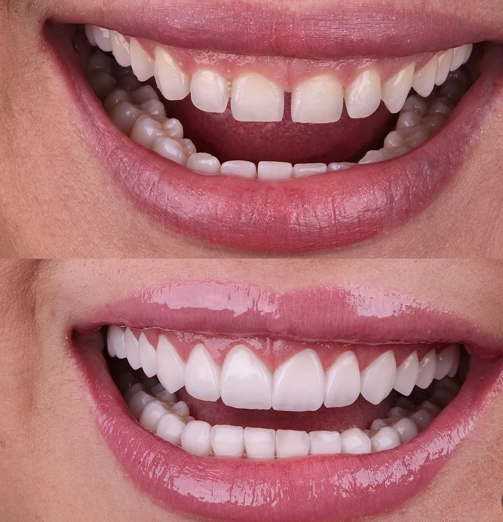 transformation dentaire